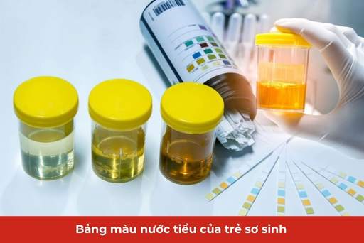 bảng màu nước tiểu của trẻ sơ sinh thumb