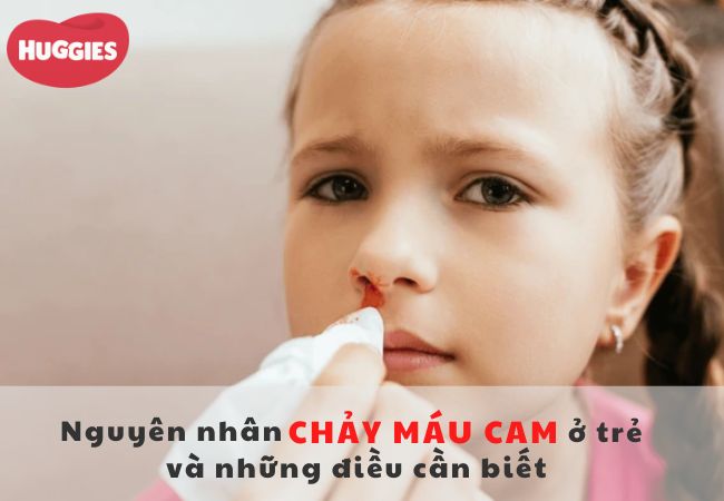 Trẻ bị chảy máu cam