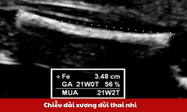 chieu-dai-xuong-dui-thai-nhi-thumb