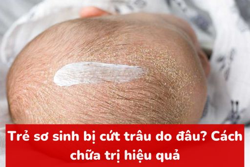 cut-trau-tre-so-sinh-thumbnail