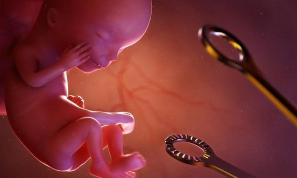 Mẹ có tiền sử nạo phá thai có khả năng mang thai thấp hơn bình thường