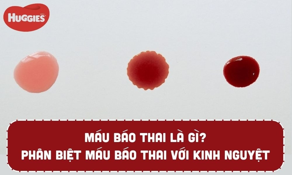 máu báo thai là gì thumb