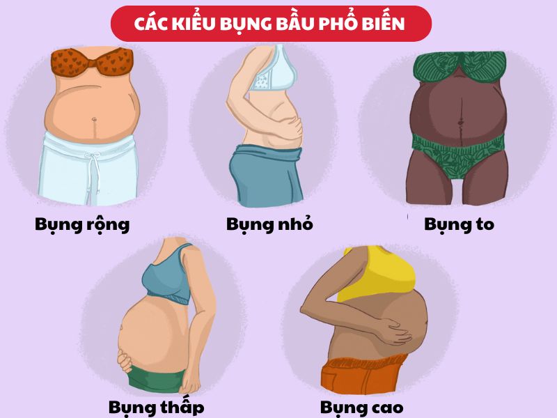 các kiểu bụng bầu