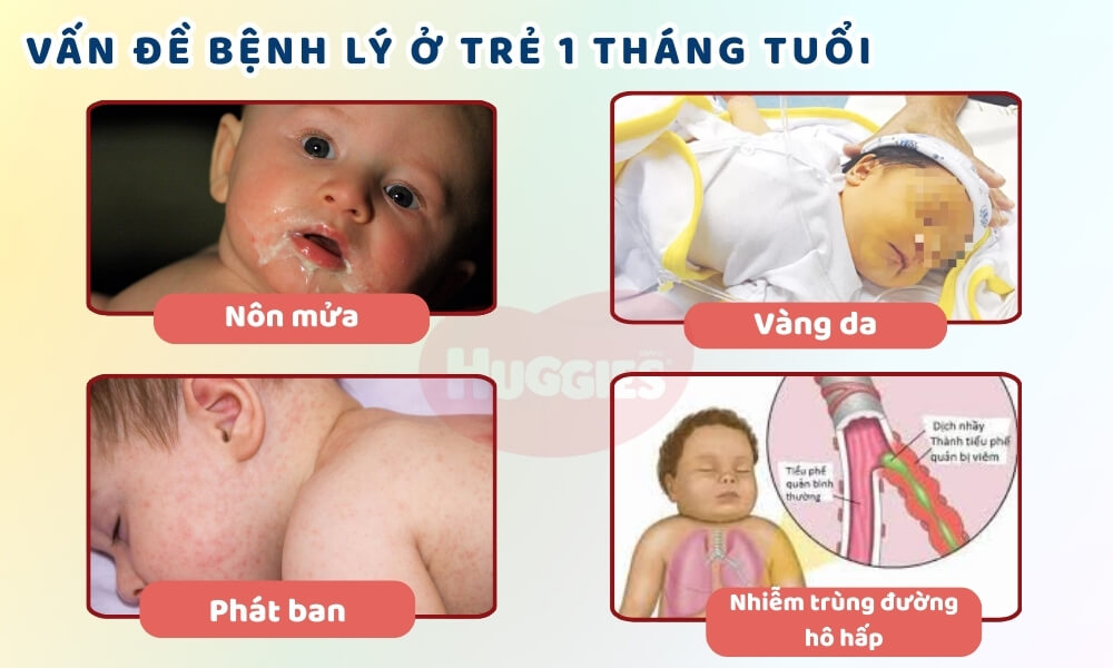 vấn đề bệnh lý ở trẻ 1 tháng tuổi