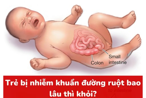 trẻ bị nhiễm khuẩn bao lâu thì khỏi 