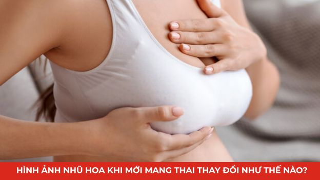 hình ảnh nhũ hoa khi mang thai