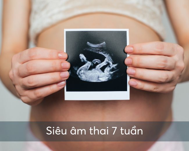 Siêu âm thai 7 tuần
