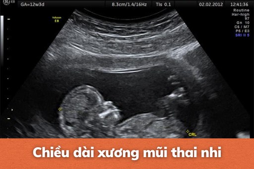 chieu dai xuong mui thai nhi thumb