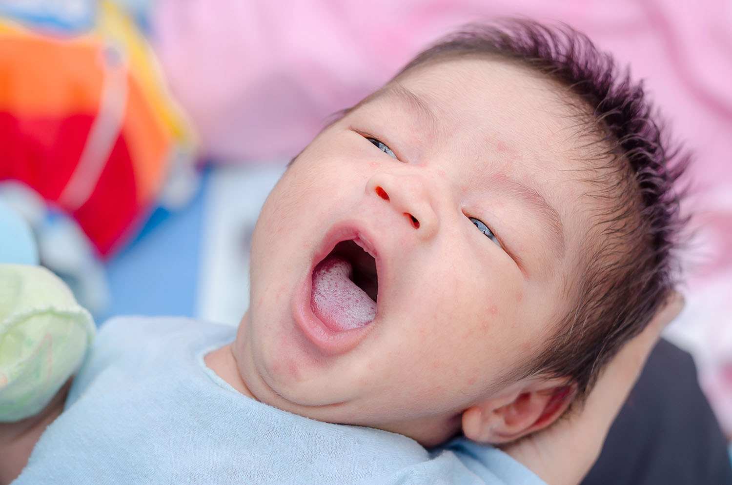  lưỡi bình thường của trẻ sơ sinh