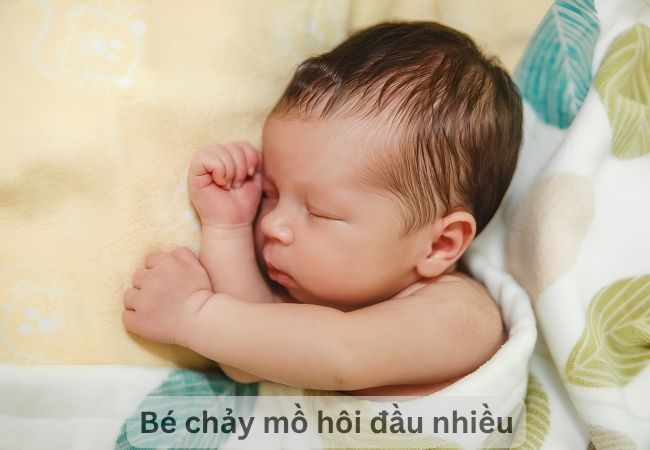 Bé chảy nhiều mồ hôi đầu gây viêm da tiết bã