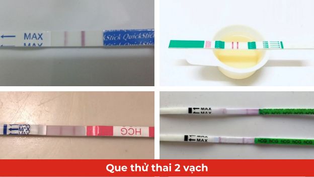 Que thử thai hiện vạch đậm, nhạt