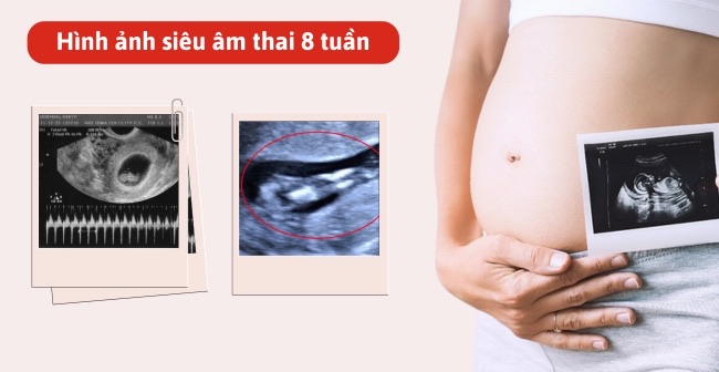 Hình ảnh thai nhi 8 tuần tuổi qua siêu âm
