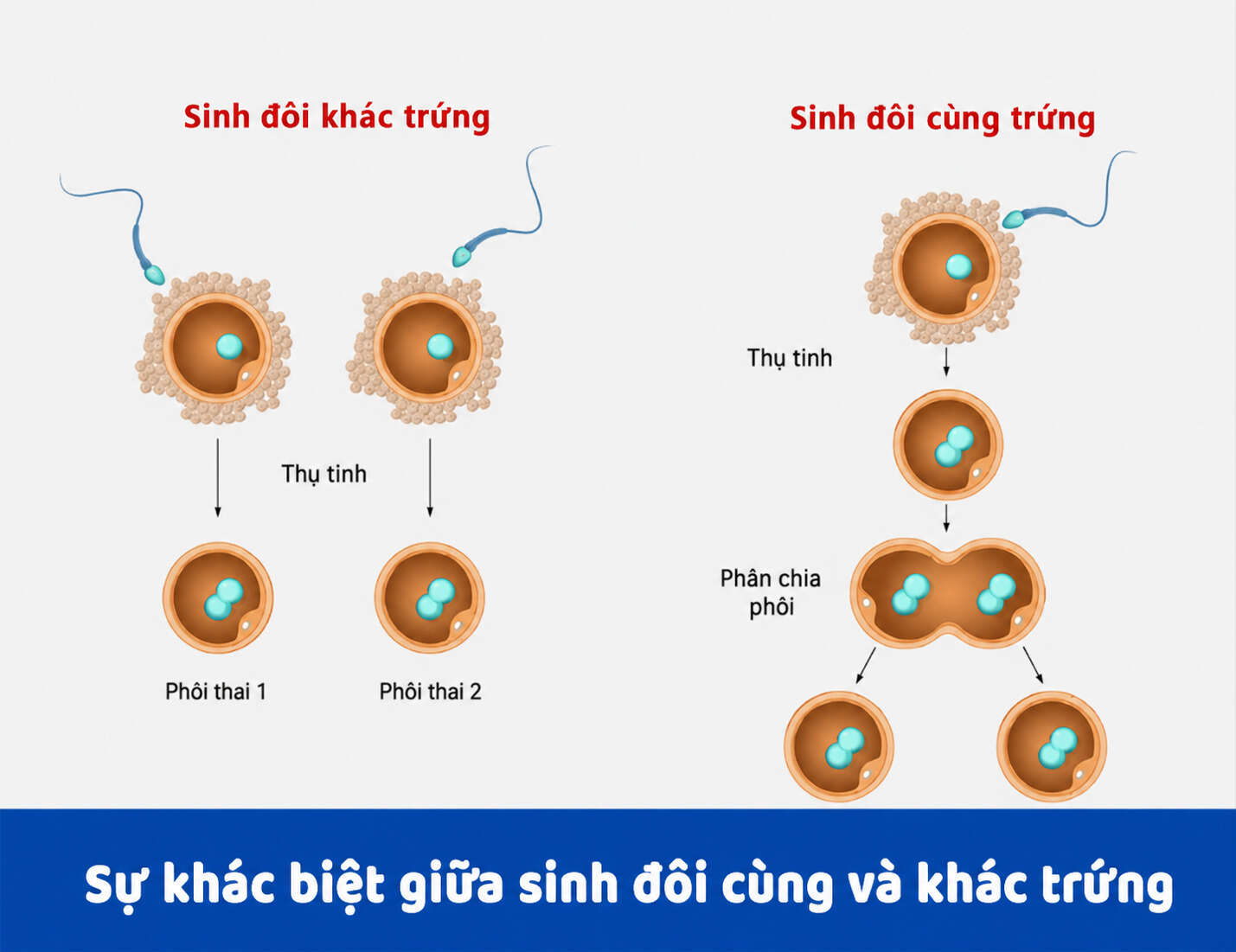 sinh đôi cùng trứng và sinh đôi khác trứng