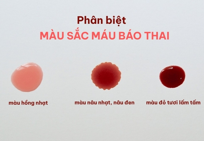 hình ảnh máu báo thai