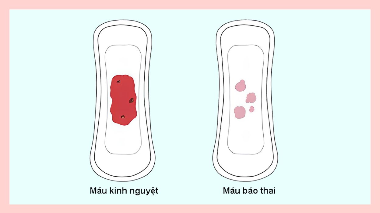 sự khác nhau giữa chậm kinh và mang thai