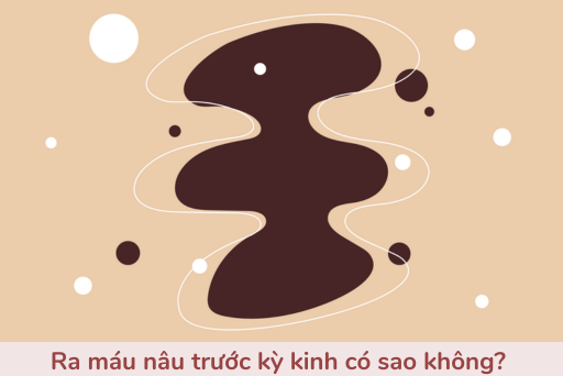 ra máu trước kỳ kinh có sao không