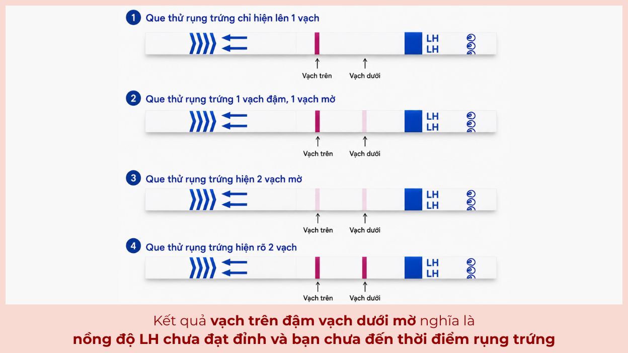 Que thử rụng trứng vạch trên đậm vạch dưới mờ cho thấy nồng độ LH chưa đạt đỉnh